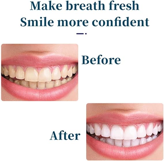 SP-4 Probiotic Ultra Whitening Toothpaste