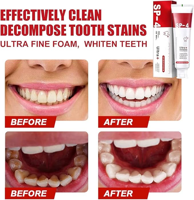 SP-4 Probiotic Ultra Whitening Toothpaste